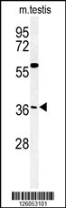 Western blot analysis of CCD92 Antibody (Center) (Cat. #AP5018c) in mouse testis tissue lysates (35ug/lane).CCD92 (arrow) was detected using the purified Pab.