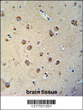 TECTB antibody (N-term) (Cat. #AP10280a) immunohistochemistry analysis in formalin fixed and paraffin embedded human brain tissue followed by peroxidase conjugation of the secondary antibody and DAB staining. This data demonstrates the use of the TECTB antibody (N-term) for immunohistochemistry. Clinical relevance has not been evaluated.