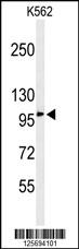 Western blot analysis of EFR3A Antibody (C-term) (Cat. #AP4982b) in K562 cell line lysates (35ug/lane). EFR3A (arrow) was detected using the purified Pab.