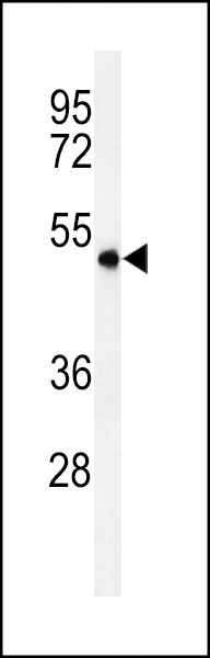 Western blot analysis of ASM3A Antibody (C-term) (Cat. #AP4977b) in MDA-MB435 cell line lysates (35ug/lane). ASM3A (arrow) was detected using the purified Pab.