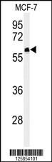 Western blot analysis of FA20A Antibody (N-term) (Cat. #AP4969a) in MCF-7 cell line lysates (35ug/lane). FA20A (arrow) was detected using the purified Pab.