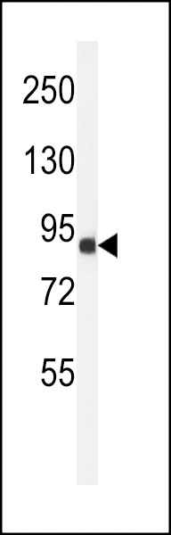 Western blot analysis of ANR49 Antibody (Center) (Cat. #AP4966c) in Jurkat cell line lysates (35ug/lane). ANR49 (arrow) was detected using the purified Pab.