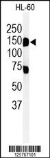 Western blot analysis of T131L Antibody (C-term) (Cat. #AP4964b) in HL-60 cell line lysates (35ug/lane). T131L (arrow) was detected using the purified Pab.