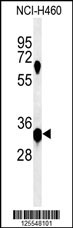 Western blot analysis of KCTD1 Antibody (C-term) (Cat. #AP4955b) in NCI-H460 cell line lysates (35ug/lane). KCTD1 (arrow) was detected using the purified Pab.