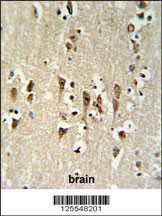 KCTD1 Antibody (C-term) (Cat. #AP4955b) IHC analysis in formalin fixed and paraffin embedded brain tissue followed by peroxidase conjugation of the secondary antibody and DAB staining. This data demonstrates the use of the KCTD1 Antibody (C-term) for immunohistochemistry. Clinical relevance has not been evaluated.