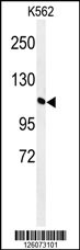 Western blot analysis of GTD2A Antibody (C-term) (Cat. #AP4949b) in K562 cell line lysates (35ug/lane). GTD2A (arrow) was detected using the purified Pab.