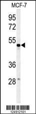 Western blot analysis of PSG7 Antibody (C-term) (Cat. #AP4939b) in MCF-7 cell line lysates (35ug/lane). PSG7 (arrow) was detected using the purified Pab.