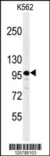 Western blot analysis of SE6L2 Antibody (C-term) (Cat. #AP4937b) in K562 cell line lysates (35ug/lane). SE6L2 (arrow) was detected using the purified Pab.