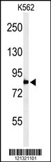 Western blot analysis of PLA2G4B Antibody (Center) (Cat. #AP4919c) in K562 cell line lysates (35ug/lane). PLA2G4B (arrow) was detected using the purified Pab.