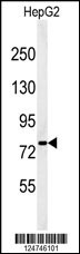 Western blot analysis of YMEL1 Antibody (N-term) (Cat. #AP4882a) in HepG2 cell line lysates (35ug/lane). YMEL1 (arrow) was detected using the purified Pab.