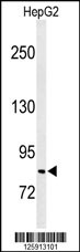Western blot analysis of C19orf21 Antibody (N-term) (Cat. #AP4851a) in HepG2 cell line lysates (35ug/lane). C19orf21 (arrow) was detected using the purified Pab.