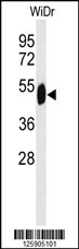 Western blot analysis of SETD6 Antibody (C-term) (Cat. #AP4848b) in WiDr cell line lysates (35ug/lane). SETD6 (arrow) was detected using the purified Pab.