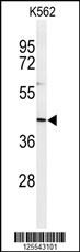 Western blot analysis of IN80B Antibody (Center) (Cat. #AP4837c) in K562 cell line lysates (35ug/lane). IN80B (arrow) was detected using the purified Pab.