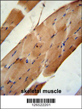 CNO6L Antibody (C-term) (Cat. #AP5207a) immunohistochemistry analysis in formalin fixed and paraffin embedded human skeletal muscle followed by peroxidase conjugation of the secondary antibody and DAB staining. This data demonstrates the use of the CNO6L Antibody (C-term) for immunohistochemistry. Clinical relevance has not been evaluated.