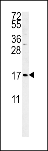 SMAGP Antibody (Center)（Cat. #AP5271c）western blot analysis in K562 cell line lysates (35ug/lane).  This demonstrates the SMAGP antibody detected the SMAGP protein (arrow).