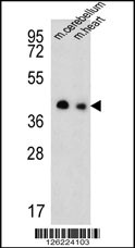 Western blot analysis of SLC25A19 Antibody (C-term) (Cat. #AP5269b) in mouse cerebellum,heart tissue lysates (35ug/lane).SLC25A19 (arrow) was detected using the purified Pab.