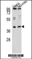 Western blot analysis of RSAD1 Antibody (C-term) (Cat. #AP5262b) in HepG2,NCI-H460 cell line lysates (35ug/lane).RSAD1 (arrow) was detected using the purified Pab.
