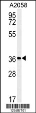 Western blot analysis of MFSD3 Antibody (Center) (Cat. #AP5245c) in A2058 cell line lysates (35ug/lane).MFSD3 (arrow) was detected using the purified Pab.