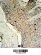 MFSD3 Antibody (Center) (Cat. #AP5245c) IHC analysis in formalin fixed and paraffin embedded human skin tissue followed by peroxidase conjugation of the secondary antibody and DAB staining. This data demonstrates the use of the MFSD3 Antibody (Center) for immunohistochemistry. Clinical relevance has not been evaluated.