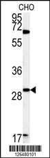 Western blot analysis of LHPL2 Antibody (C-term) (Cat. #AP5242b) in CHO cell line lysates (35ug/lane).LHPL2 (arrow) was detected using the purified Pab.
