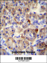 SPRED3 antibody (N-term) (Cat. #AP10262a) immunohistochemistry analysis in formalin fixed and paraffin embedded human pancreas tissue followed by peroxidase conjugation of the secondary antibody and DAB staining.This data demonstrates the use of the SPRED3 antibody (N-term) for immunohistochemistry. Clinical relevance has not been evaluated.