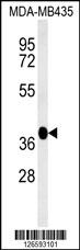 FBXL14 Antibody (C-term)（Cat. #AP5220b）western blot analysis in MDA-MB435 cell line lysates (35ug/lane).  This demonstrates the FBXL14 antibody detected the FBXL14 protein (arrow).