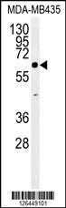 ERO1LB Antibody (C-term) (Cat. #AP5218b) western blot analysis in MDA-MB435 cell line lysates (35ug/lane).   This demonstrates the ERO1LB antibody detected the ERO1LB protein (arrow).