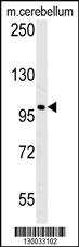 Western blot analysis of EPC2 Antibody (N-term) (Cat. #AP5217a) in mouse cerebellum tiusse lysates (35ug/lane).EPC2 (arrow) was detected using the purified Pab.