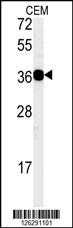 Western blot analysis of CD300LB Antibody (N-term) (Cat. #AP5203a) in CEM cell line lysates (35ug/lane).CD300LB (arrow) was detected using the purified Pab.