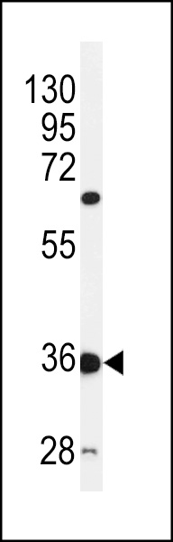 Western blot analysis of C12orf53 Antibody (N-term) (Cat. #AP5185a) in mouse liver tissue lysates (35ug/lane).C12orf53 (arrow) was detected using the purified Pab.
