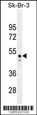 CNO6L Antibody (C-term) (Cat. #AP5207a) western blot analysis in Sk-Br-3 cell line tissue lysates (35ug/lane).This demonstrates the CNO6L antibody detected the CNO6L protein (arrow).
