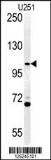 Western blot analysis of ACAP3 Antibody (N-term) (Cat. #AP5177a) in U251 cell line lysates (35ug/lane).ACAP3 (arrow) was detected using the purified Pab.