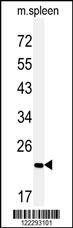 Western blot analysis of COPZ2 Antibody (C-term) (Cat. #AP5175b) in mouse spleen tissue lysates (35ug/lane).COPZ2 (arrow) was detected using the purified Pab.