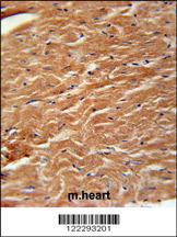 COPZ2 Antibody (C-term) (Cat. #AP5175b) immunohistochemistry analysis in formalin fixed and paraffin embedded mouse heart tissue followed by peroxidase conjugation of the secondary antibody and DAB staining. This data demonstrates the use of the COPZ2 Antibody (C-term) for immunohistochemistry. Clinical relevance has not been evaluated.