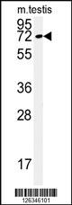 Western blot analysis of KLHL9 Antibody (Center) (Cat. #AP5173c) in mouse testis tissue lysates (35ug/lane).KLHL9 (arrow) was detected using the purified Pab.