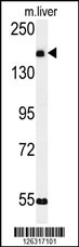 Western blot analysis of KIAA1529 Antibody (C-term) (Cat. #AP5165b) in mouse liver tissue lysates (35ug/lane).KIAA1529 (arrow) was detected using the purified Pab.