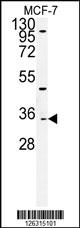 Western blot analysis of TTPAL Antibody (C-term) (Cat. #AP5164b) in MCF-7cell line lysates (35ug/lane).TTPAL (arrow) was detected using the purified Pab.