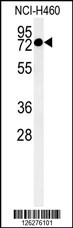 Western blot analysis of CCDC62 Antibody (C-term) (Cat. #AP5157b) in NCI-H460 cell line lysates (35ug/lane).CCDC62 (arrow) was detected using the purified Pab.