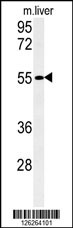 Western blot analysis of FAM151A Antibody (C-term) (Cat. #AP5152b) in mouse liver tissue lysates (35ug/lane).FAM151A (arrow) was detected using the purified Pab.