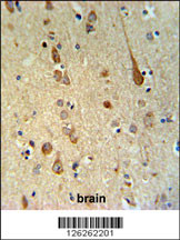 FAAH2 Antibody (C-term) (Cat. #AP5150b) IHC analysis in formalin fixed and paraffin embedded human brain tissue followed by peroxidase conjugation of the secondary antibody and DAB staining. This data demonstrates the use of the FAAH2 Antibody (C-term) for immunohistochemistry. Clinical relevance has not been evaluated.