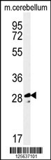 Western blot analysis of TESC Antibody (C-term) (Cat. #AP5136b) in mouse cerebellum tissue lysates (35ug/lane).TESC (arrow) was detected using the purified Pab.