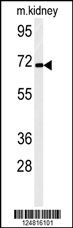 Western blot analysis of FA40B Antibody (N-term) (Cat. #AP5134a) in mouse kidney tissue lysates (35ug/lane).FA40B (arrow) was detected using the purified Pab.