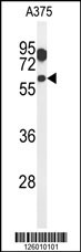 Western blot analysis of ZACN Antibody (C-term) (Cat. #AP5090b) in A375 cell line lysates (35ug/lane).ZACN (arrow) was detected using the purified Pab.