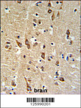 SGTB Antibody (N-term) (Cat. #AP5076a) IHC analysis in formalin fixed and paraffin embedded human brain tissue followed by peroxidase conjugation of the secondary antibody and DAB staining. This data demonstrates the use of the SGTB Antibody (N-term) for immunohistochemistry. Clinical relevance has not been evaluated.