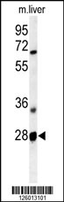 Western blot analysis of RTP2 Antibody (Center) (Cat. #AP5073c) in mouse liver tissue lysates (35ug/lane).RTP2 (arrow) was detected using the purified Pab.