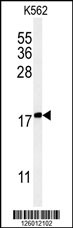 Western blot analysis of KRTAP1-1 Antibody (Center) (Cat. #AP5050c) in K562 cell line lysates (35ug/lane).KRTAP1-1 (arrow) was detected using the purified Pab.