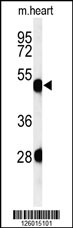 Western blot analysis of KRT82 Antibody (Center) (Cat. #AP5049c) in mouse heart tissue lysates (35ug/lane).KRT82 (arrow) was detected using the purified Pab.