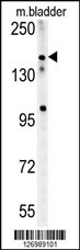 CASZ1 Antibody (C-term) (Cat. #AP10238b) western blot analysis in mouse bladder tissue lysates (15ug/lane).This demonstrates the CASZ1 antibody detected CASZ1 protein (arrow).