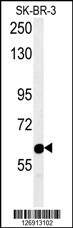 RADIL Antibody (C-term) (Cat. #AP10237b) western blot analysis in SK-BR-3 cell line lysates (15ug/lane).This demonstrates the RADIL antibody detected RADIL protein (arrow).