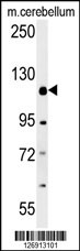 RADIL Antibody (C-term) (Cat. #AP10237b) western blot analysis in mouse cerebellum tissue lysates (15ug/lane).This demonstrates the RADIL antibody detected RADIL protein (arrow).
